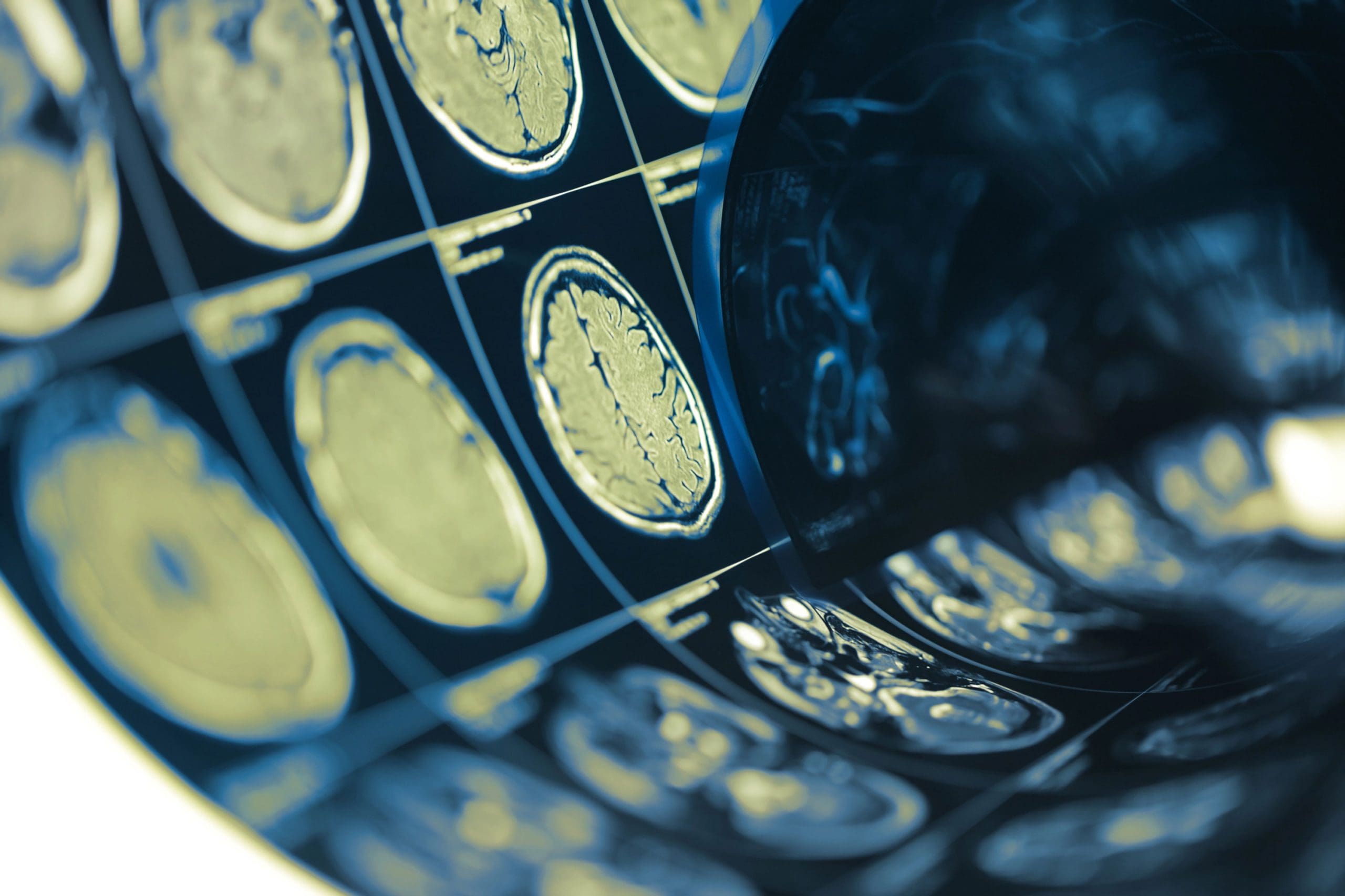 Image of multiple brain scans